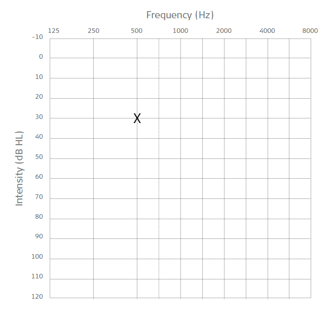 What Is An Audiogram The MED EL Blog What Is An Audiogram The MED EL Blog