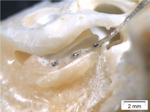 An electrode array positioned within an electrode