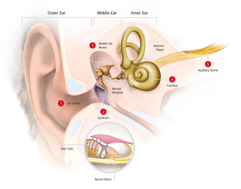 Was Ist Ein Cochlea Implantat blog.medel.com