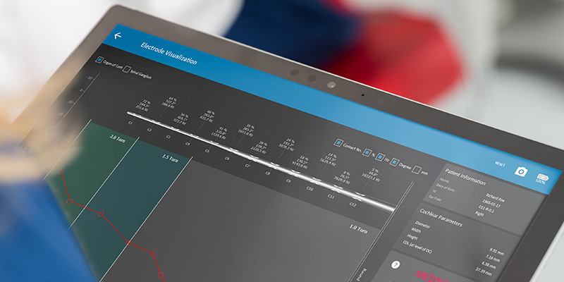 Advanced new software allows an individualized approach to electrode arrays