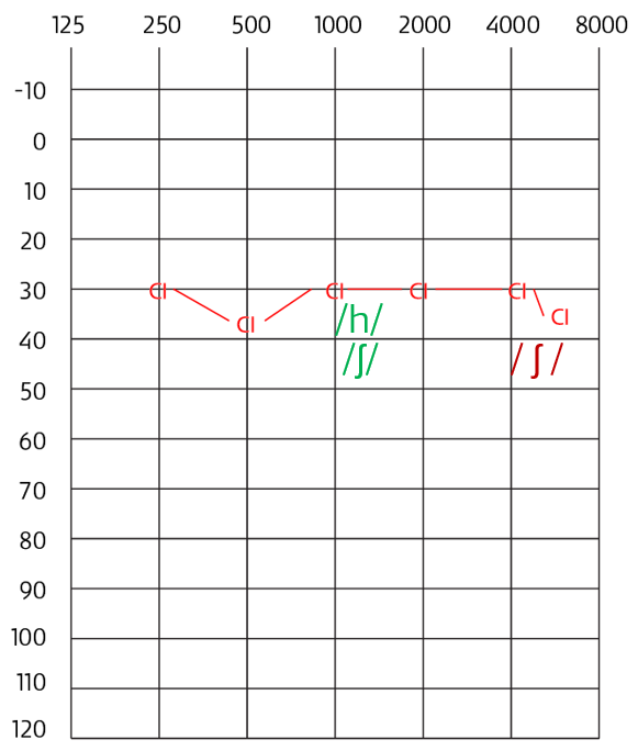Figure 2 Example audiogram—Behavioral CI thresholds. Formants for /h/ and /ʃ/ in green and red.